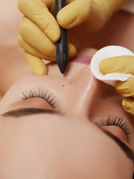 traitement-electrocoagulation-brossard